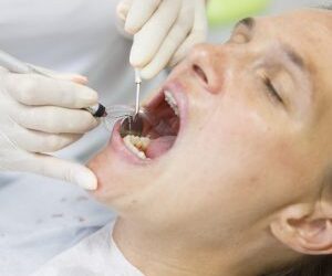 Parodontite: cause e sintomi