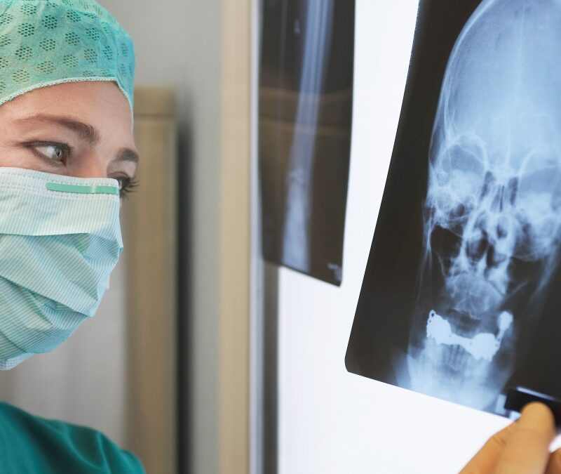 Implantologia con poco osso: come superare l’atrofia ossea